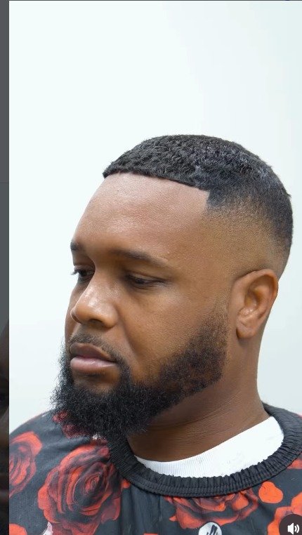 Client after men's hair unit installation