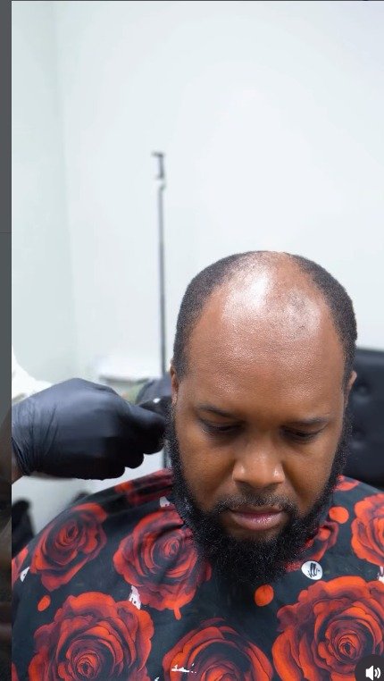 Client before men's hair unit service